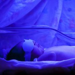 lampe jaunisse bebe