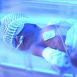 lampe jaunisse bebe