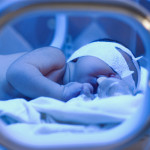 lampe jaunisse bebe