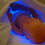 lampe jaunisse bebe
