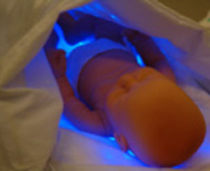 lampe jaunisse bebe