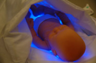 lampe jaunisse bebe